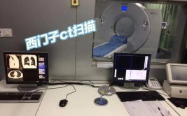 西门子开源ct,引领医疗印象技能新潮流